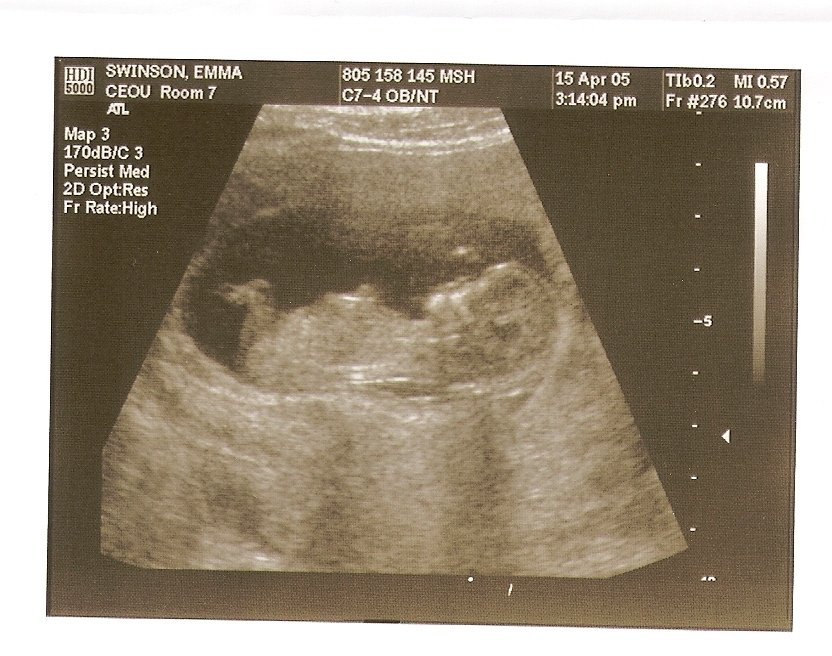 ULTRASOUND 2.0